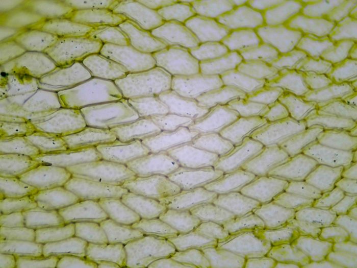 preparation microscopique feuille mousse mnium
