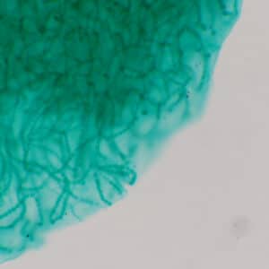 10B - Préparation microscopique de nostoc, écrasement