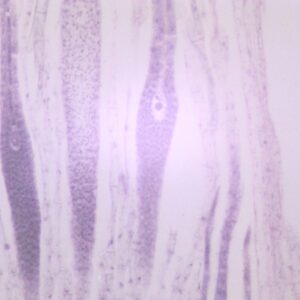 123D - Préparation microscopique d'archégones de mousse (mnium),CL