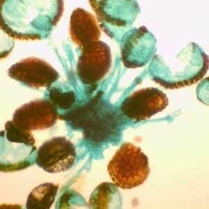151B - Préparation microscopique de sporanges et spores de fougère (polypode)
