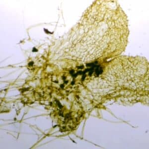 158C - Préparation microscopique de prothalle, anthéridies et archégones visibles