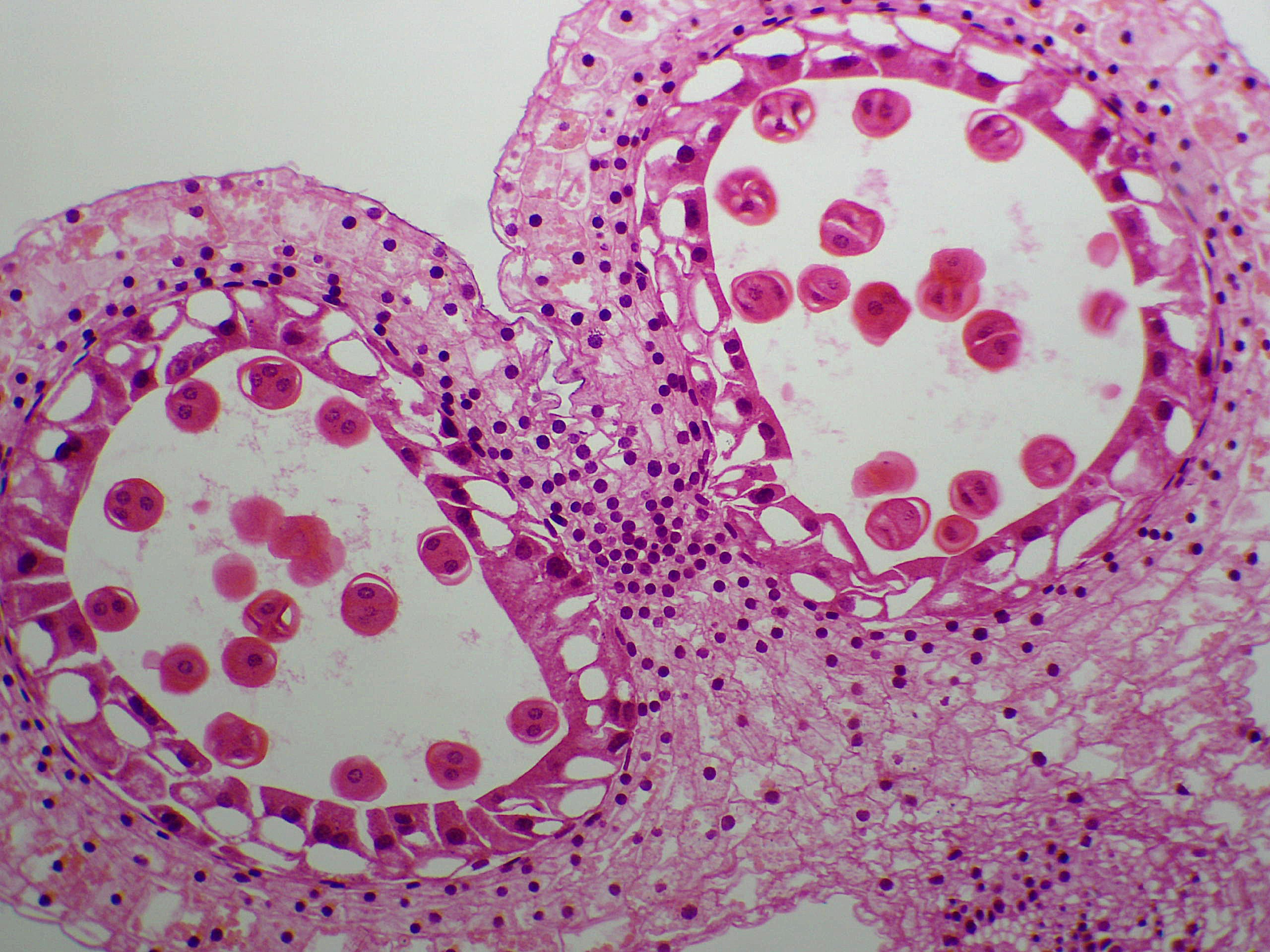 preparation microscopique anthère lis jeune prophase tretrades