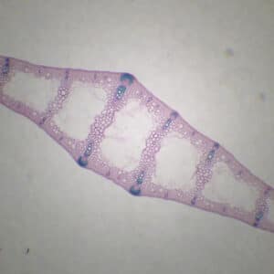 378C - Préparation microscopique de feuille d'iris CT