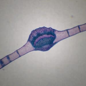 379B - Préparation microscopique de feuille de laurier cerise CT