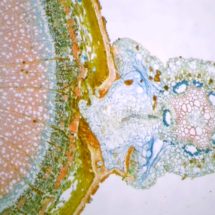 préparation microscopique Cuscute sur tige CT