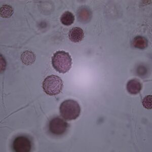 53C - Préparation microscopique de mucorale en conjugaison, zygospores