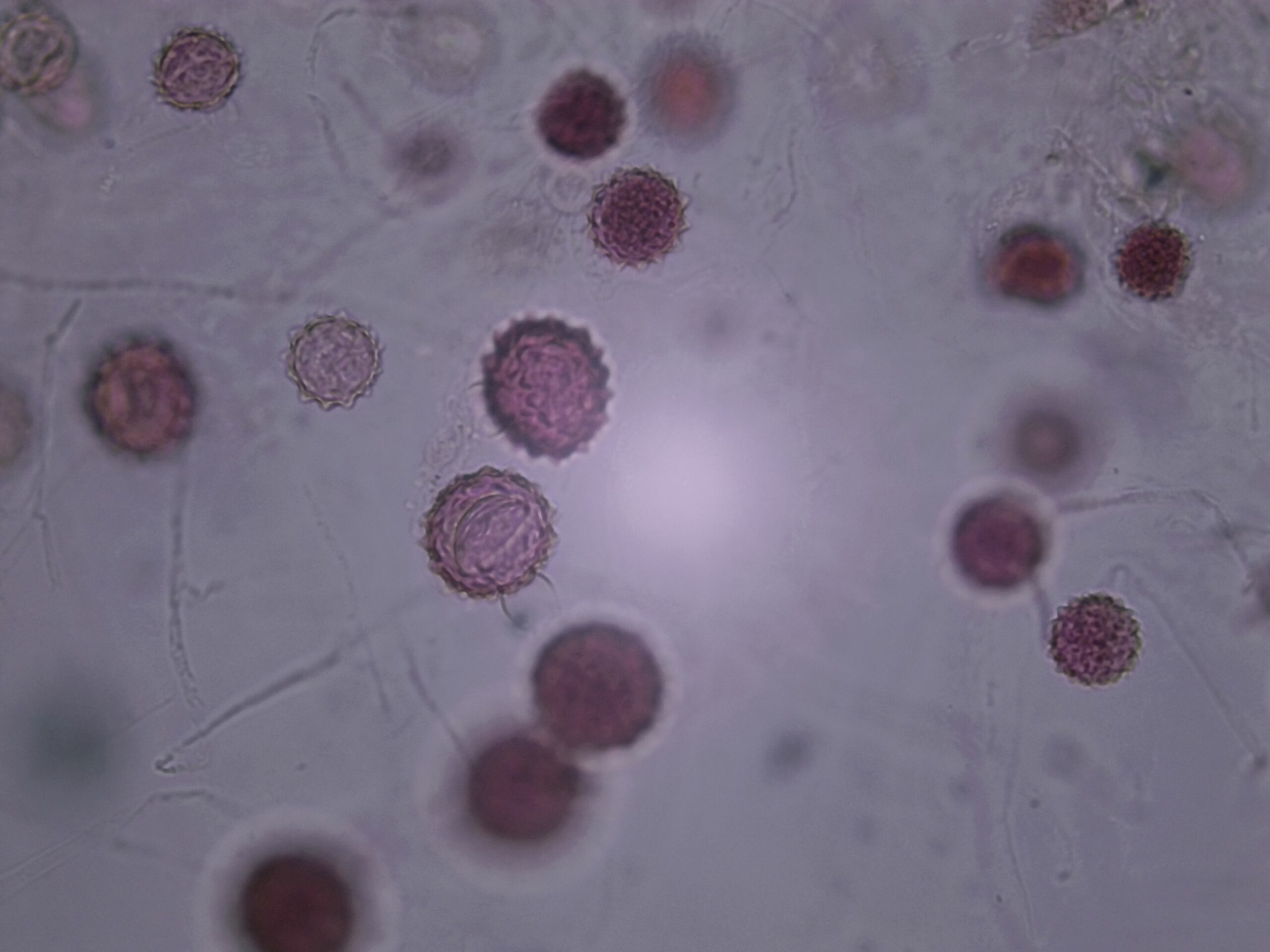 Mucorale in conjugation, zygospores