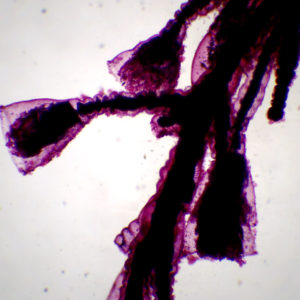 Obelia (colonie hydraire)