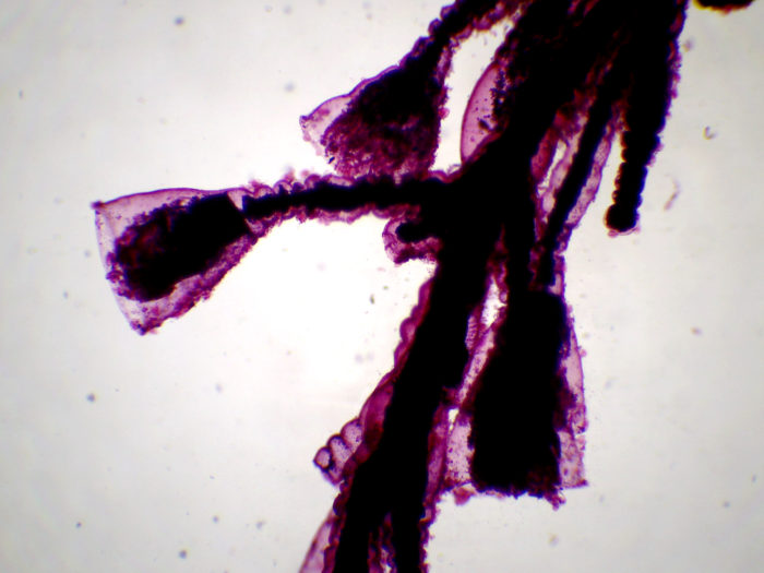 Obelia (colonie hydraire)