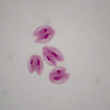 565C Paramécies conjugaison x100