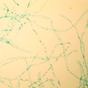 5C - Préparation-microscopique-de-spirogyre en conjugaison scalariforme