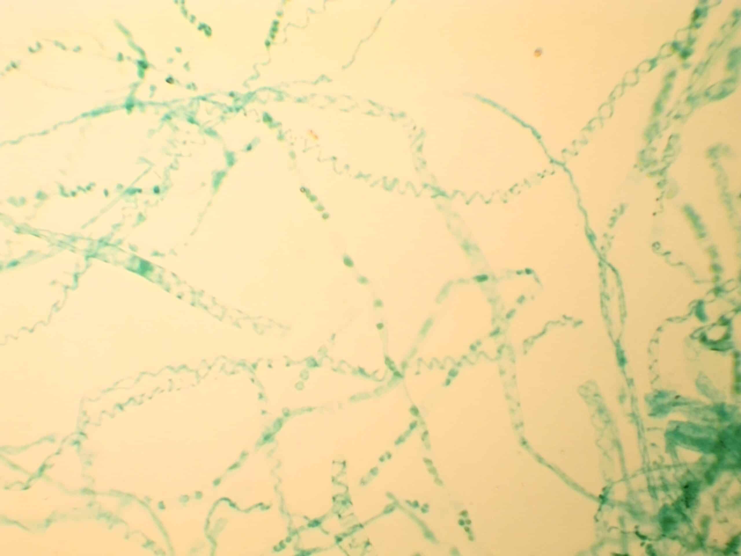 5C - Préparation-microscopique-de-spirogyre en conjugaison scalariforme