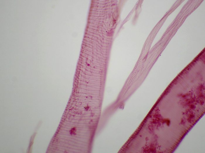 preparation microscopique trachee insecte