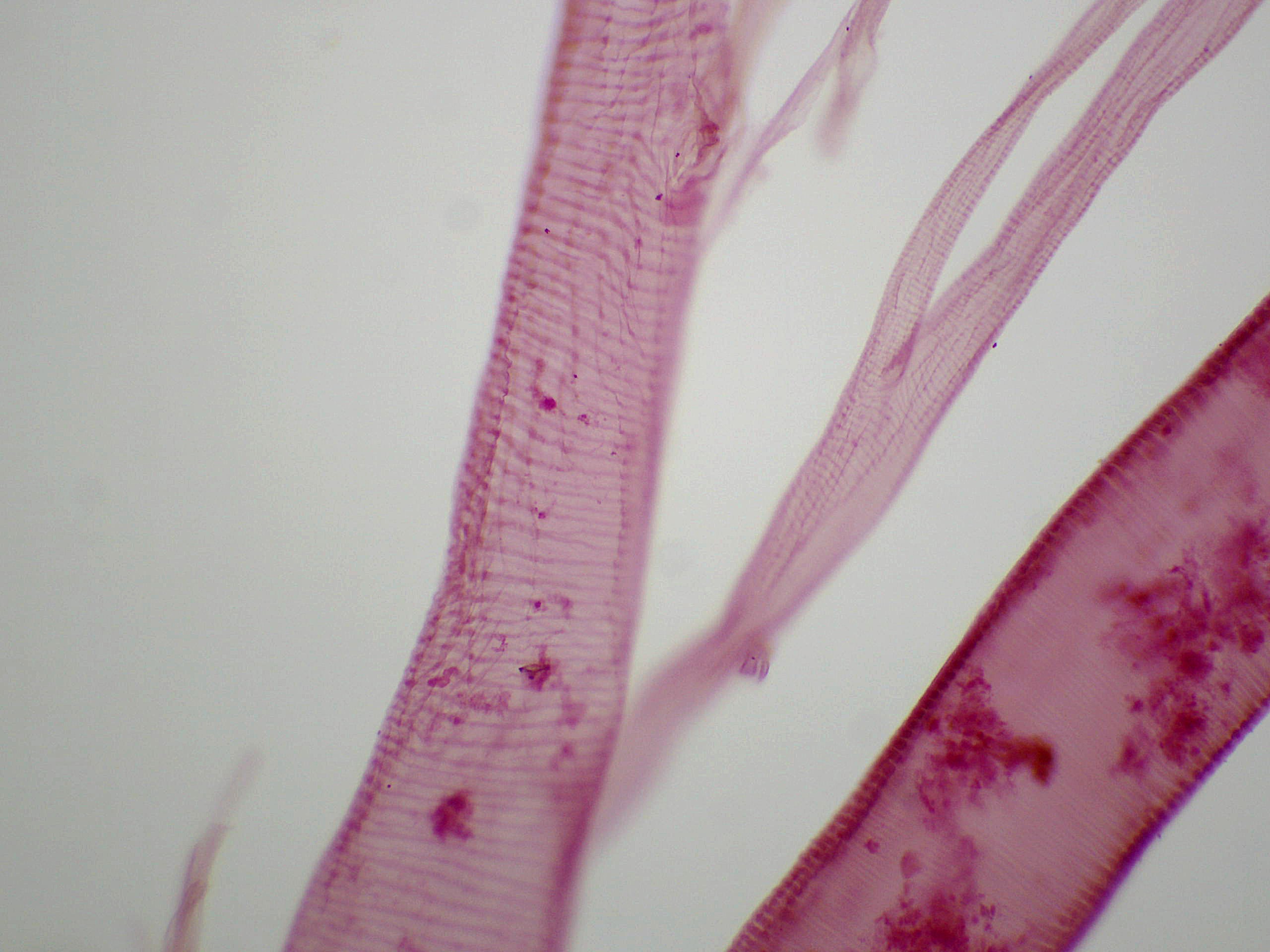 preparation microscopique trachee insecte