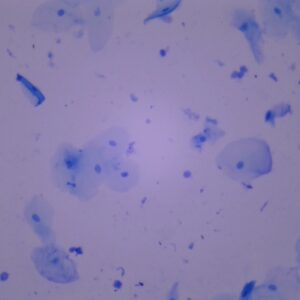 704B - Préparation microscopique de cellules buccales de l'homme