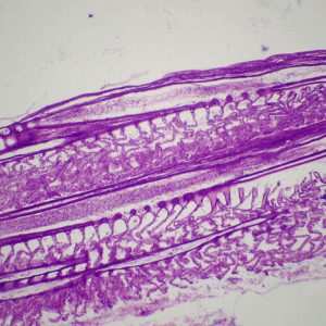 Branchies de poisson CT