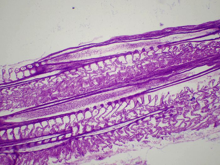 Branchies de poisson CT