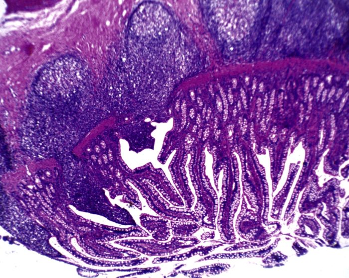 preparation microscopique duodenum CT