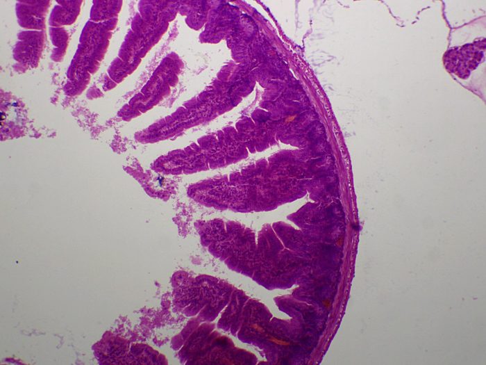 preparation microscopique intestin grele CT