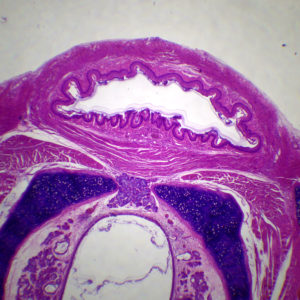 Cou du rat CT (trachée + oesophage)