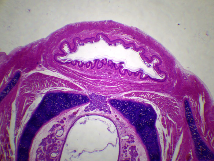 Cou du rat CT (trachée + oesophage)