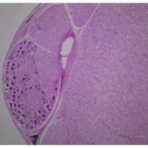 moelle + ganglion rachidien