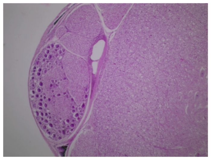 moelle + ganglion rachidien