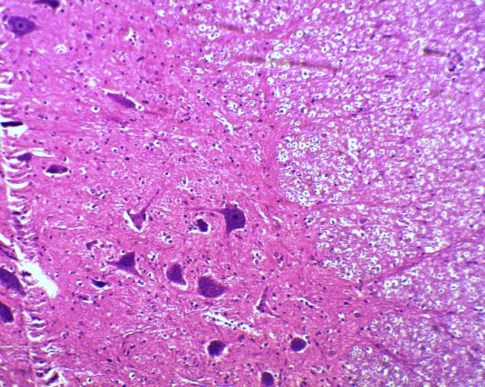 preparation microscopique neurones multipolaires CT
