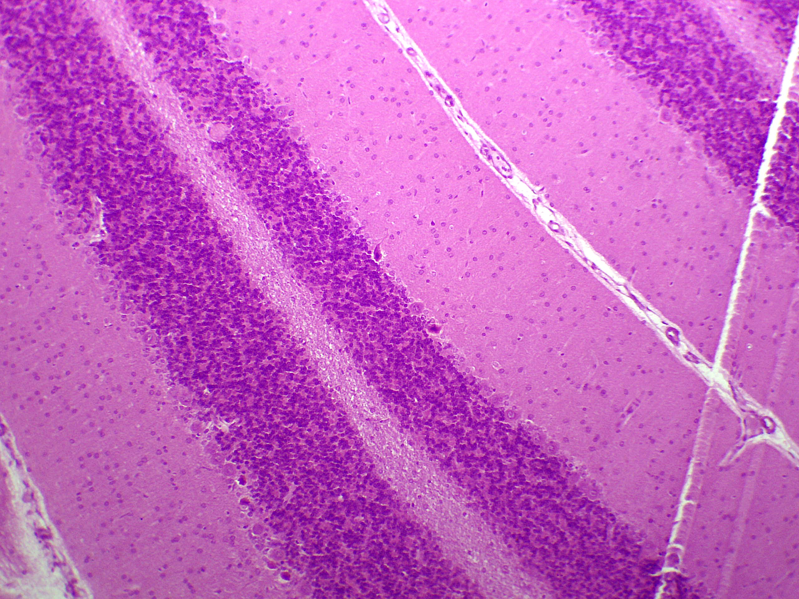 preparation microscopique neurone unipolaire