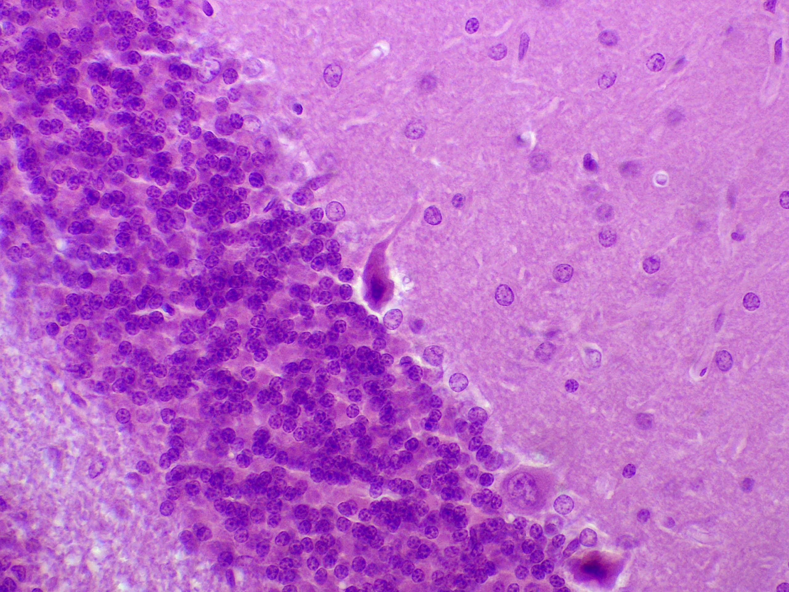 preparation microscopique neurone unipolaire