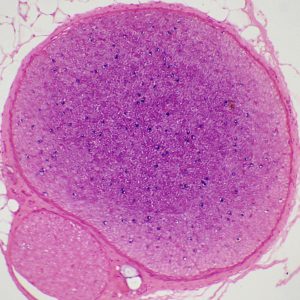 nerf CT preparatin microscopique