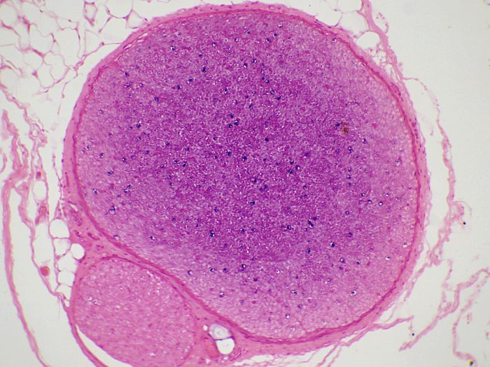 nerf CT preparatin microscopique