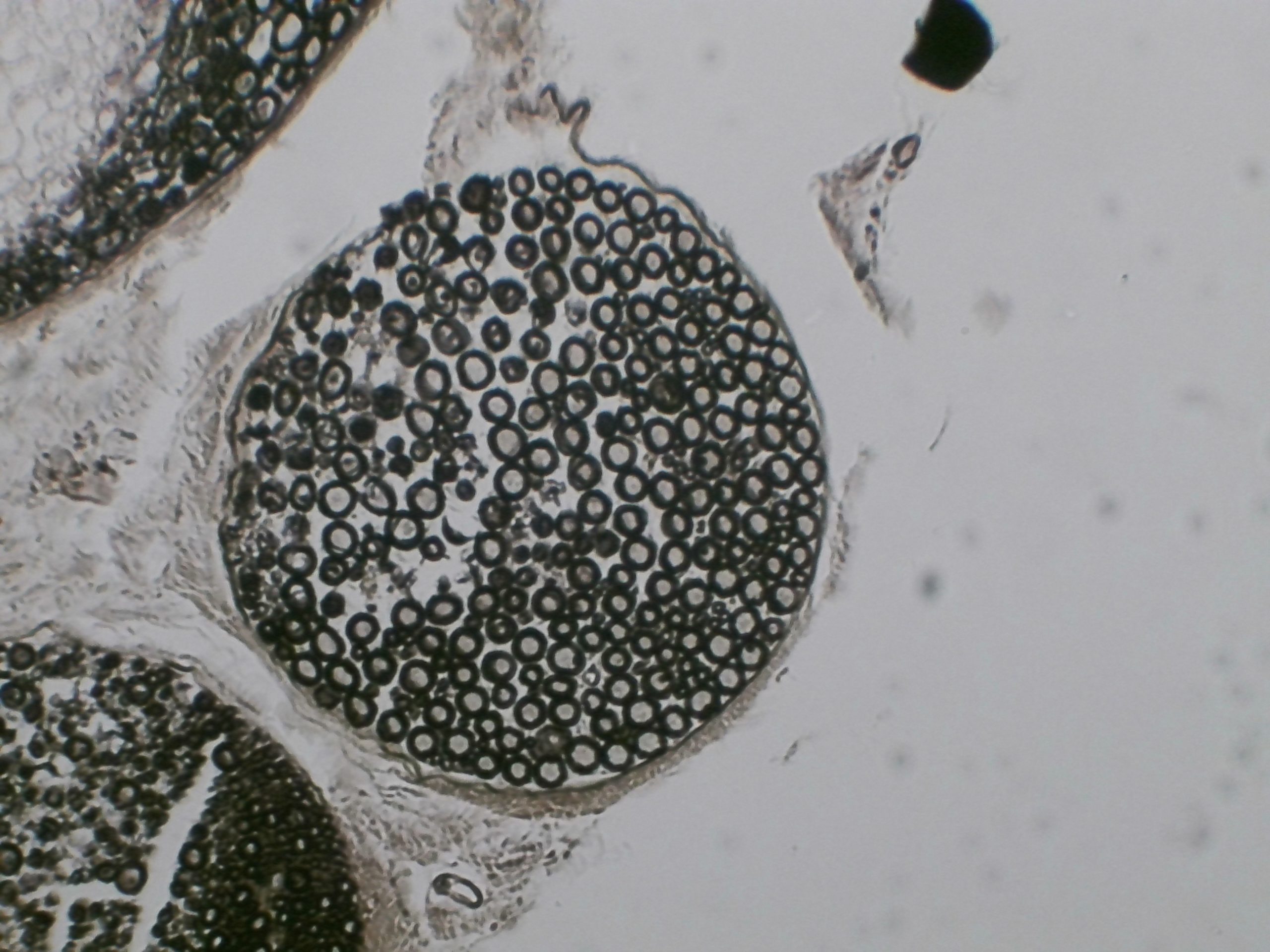 Nerf osmié CT preparation microscopique