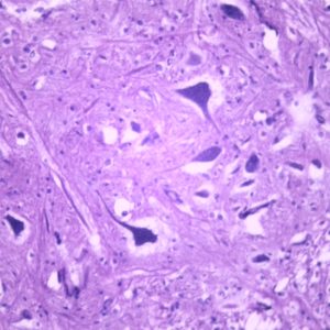 Cellules Nerveuses preparation microscopique