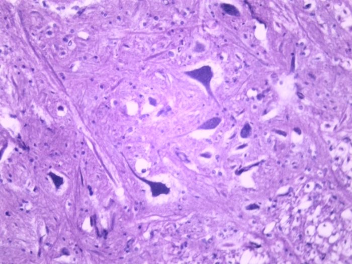Cellules Nerveuses preparation microscopique