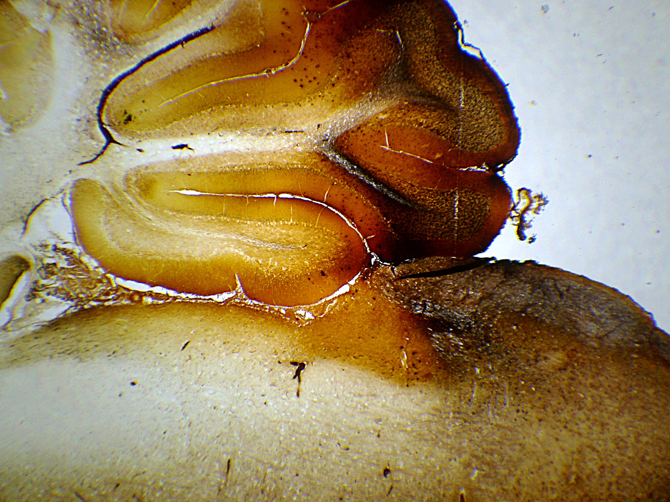 preparation microscopique Encéphale de rat cL (cajal)