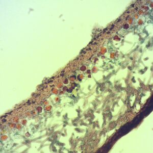 91C - Préparation microscopique de lichen, thalle CT (un seul cortex), peltigera