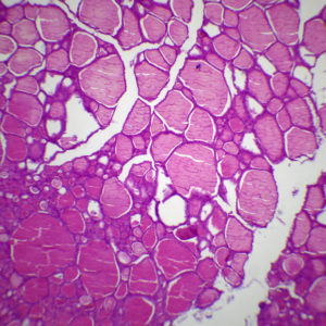 Thyroïde en hyposecrétion naturelle