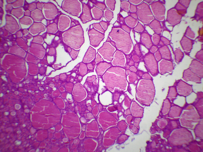 Thyroïde en hyposecrétion naturelle