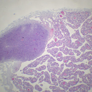 Thyroïde et Parathyroïde