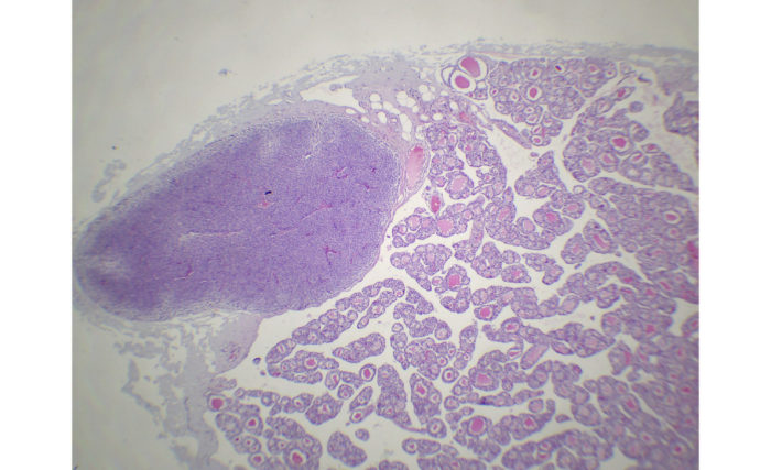 Thyroïde et Parathyroïde