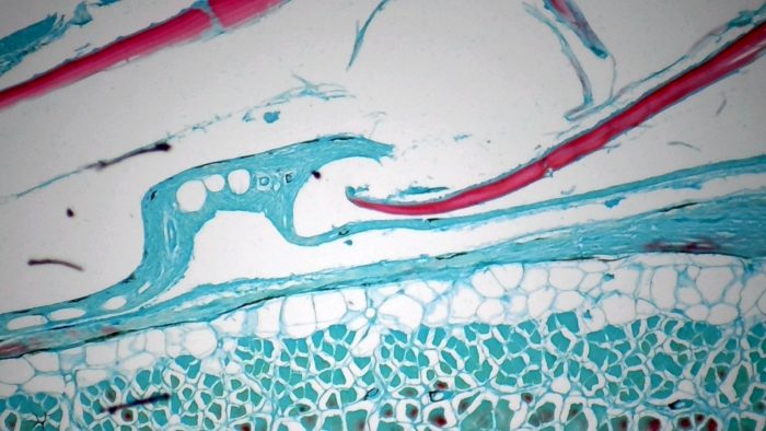 preparation microscopique peau de poisson CT