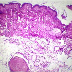 931D Peau Humaine CT