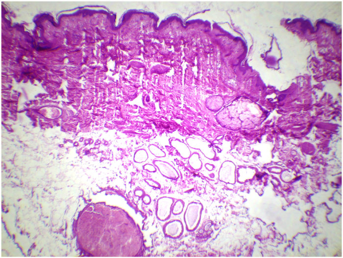 931D Peau Humaine CT