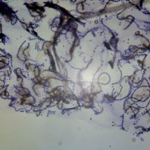 collema lichen gelatineux