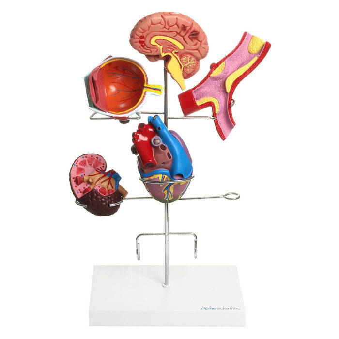 Hypertension_model