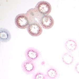 301C - Préparation microscopique de méiose anthère de lis, stades mélangés