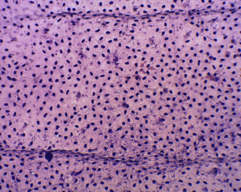 Pr paration microscopique de mue de triton begenat