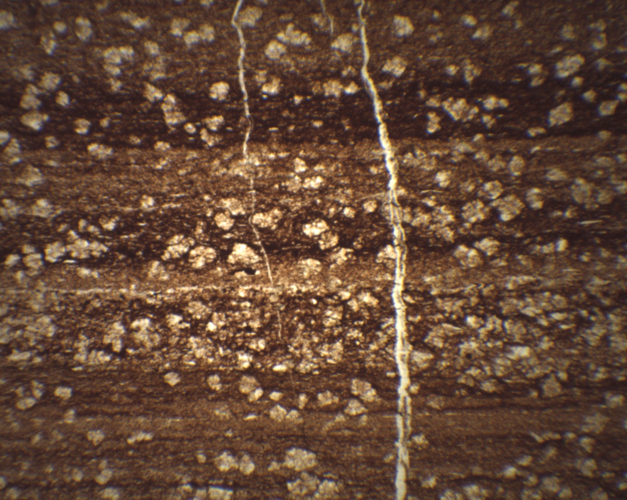radiolarite XPL