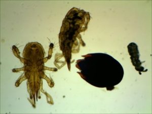 Préparation microscopique de microfaune du sol Préparation microscopique de microfaune du sol (acariens+insectes divers)